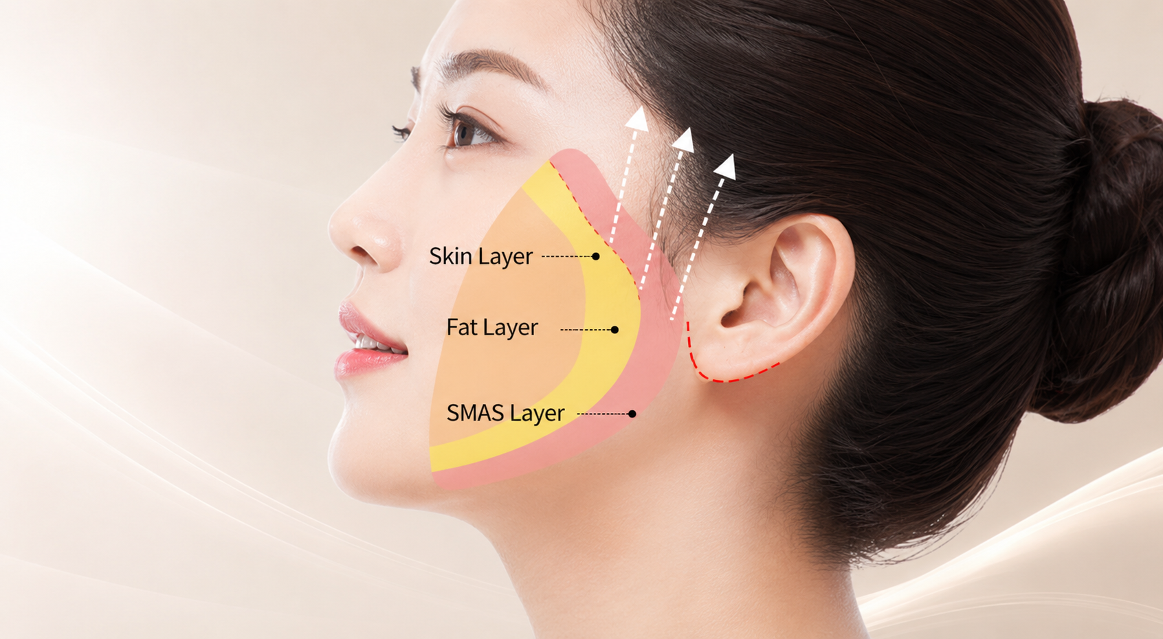 Facelift in Busan