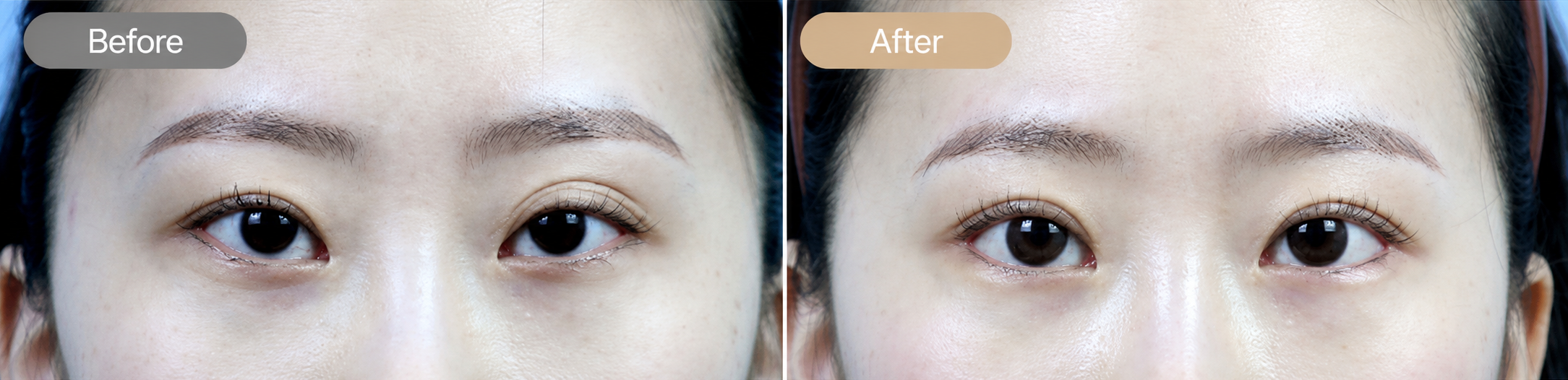Plastic Surgery in Busan