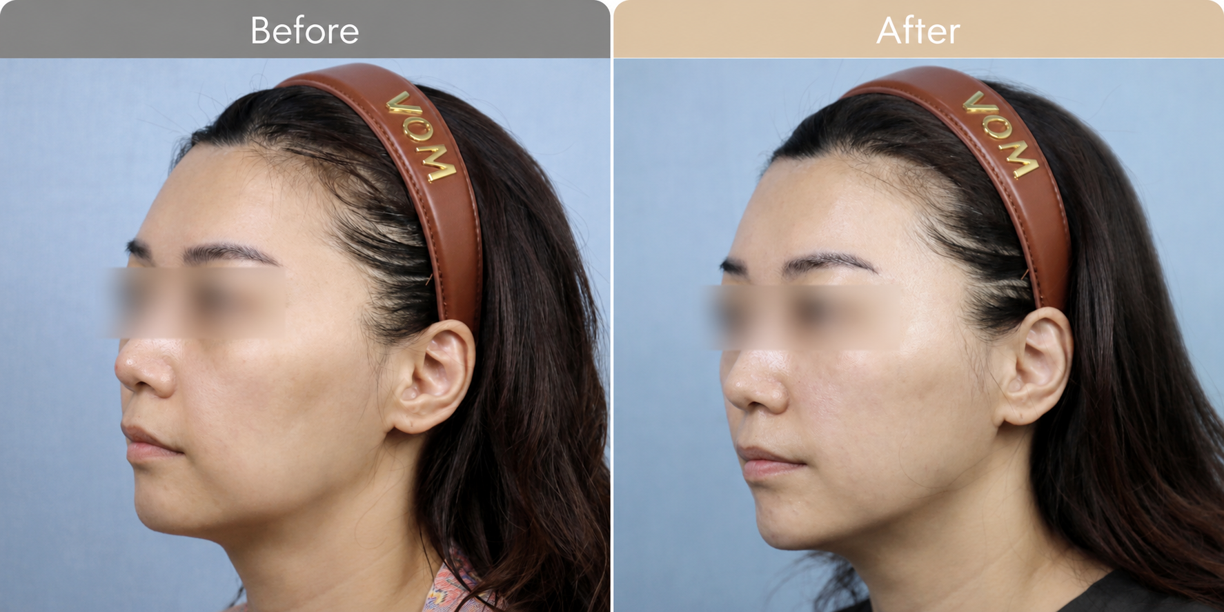 Anti-Aging Treatment in Busan